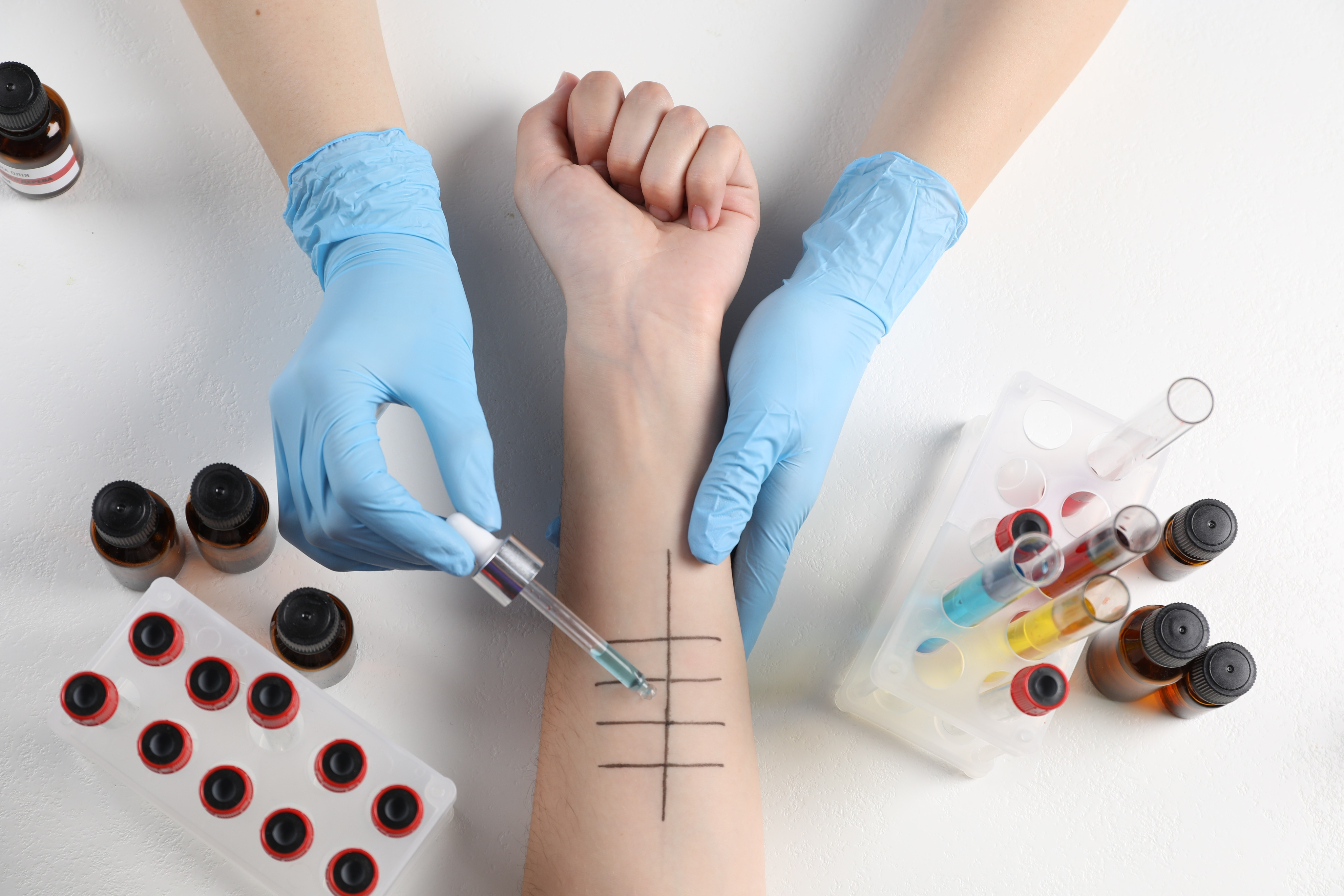 알레르기 MAST 176종 검사